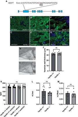 The ion channel Trpc6a regulates the cardiomyocyte regenerative response to mechanical stretch